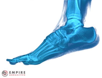 X-ray image of a human foot symbolizing the need for foot protection in abrasive work environments